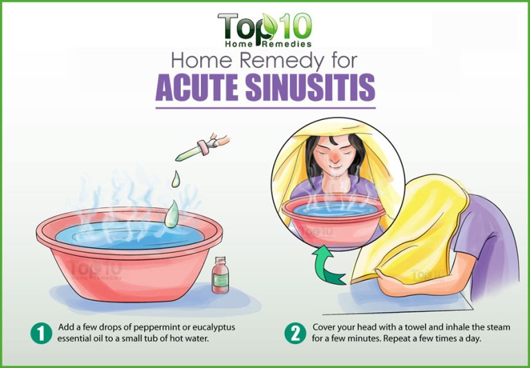 acute-sinusitis-900